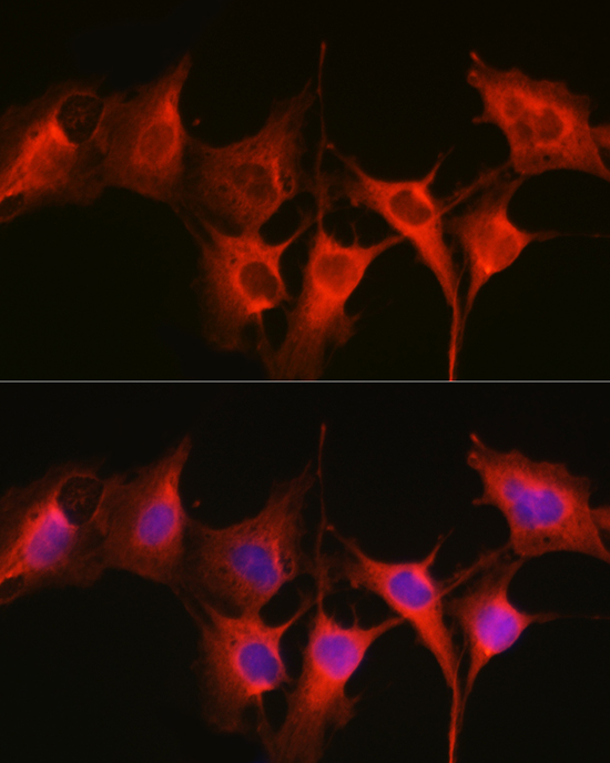 Anti-HSP70 Antibody (CAB12948)