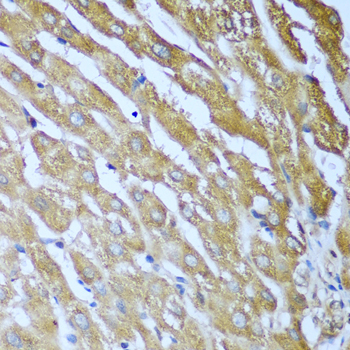 Anti-IGF2BP3 Antibody (CAB2750)