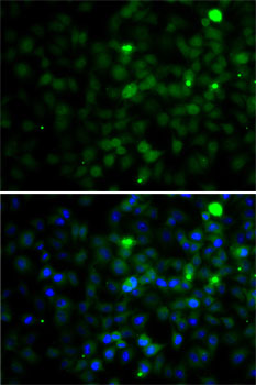 Anti-SMYD4 Antibody (CAB7310)