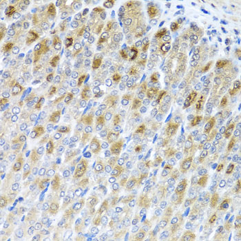 Anti-Metaxin-2 Polyclonal Antibody (CAB7958)