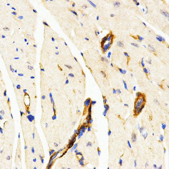 Anti-LAMP3 Antibody (CAB2895)