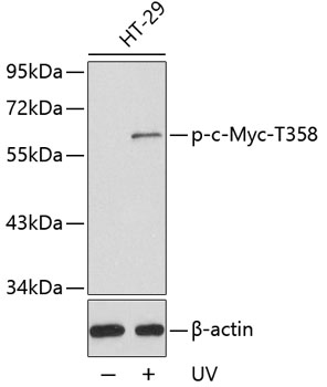 Anti-Phospho-MYC-T358 Antibody (CABP0411)