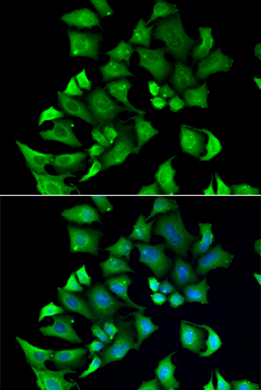 Anti-ENTPD2 Antibody (CAB6584)