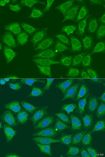 Anti-ADH7 Antibody (CAB7871)