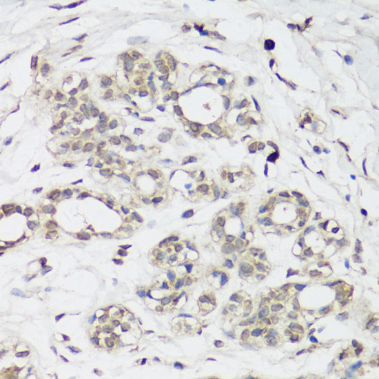 Anti-NRF2 Antibody (CAB0674)