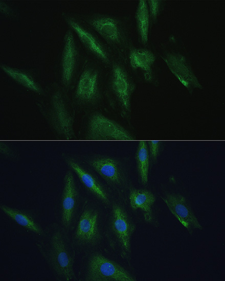 Anti-SRPRB Antibody (CAB10591)