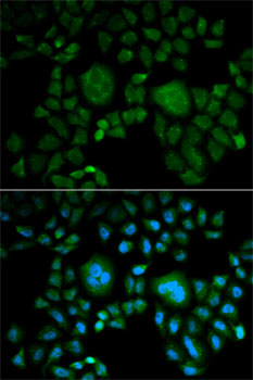 Anti-CA2 Antibody (CAB1440)