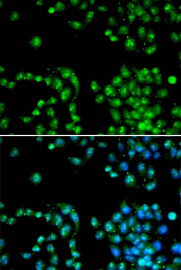 Anti-POLR2L Antibody (CAB6839)