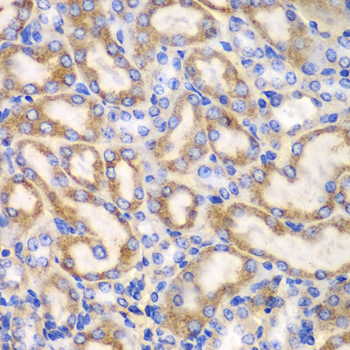 Anti-UGDH Antibody (CAB13559)