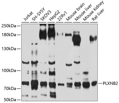 Anti-PLXNB2 Antibody (CAB10069)