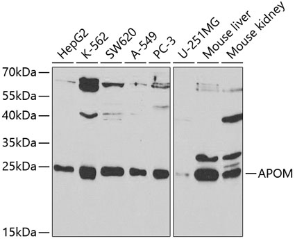 Anti-APOM Antibody (CAB5336)