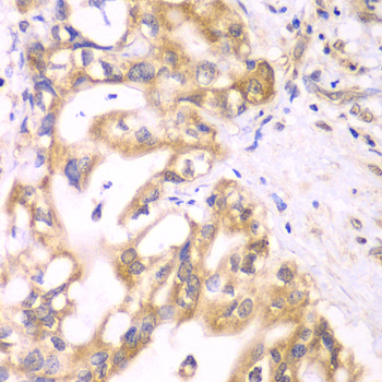 Anti-ACADS Antibody (CAB0945)