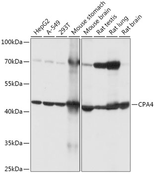 Anti-CPA4 Antibody (CAB17701)