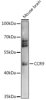 Anti-CCR9 Antibody (CAB14848)