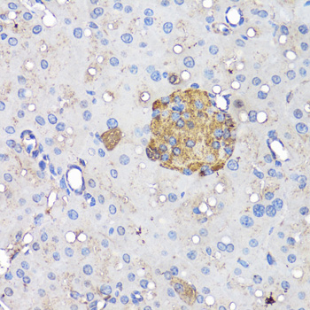 Anti-Insulin Antibody (CAB2090)