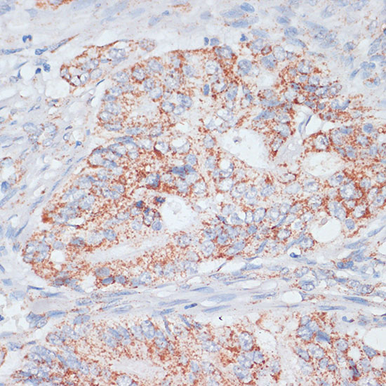 Anti-Desmoplakin Antibody (CAB7635)