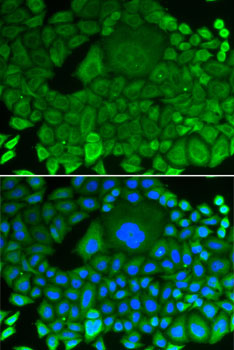 Anti-ARHGDIA Antibody [KO Validated] (CAB1214)