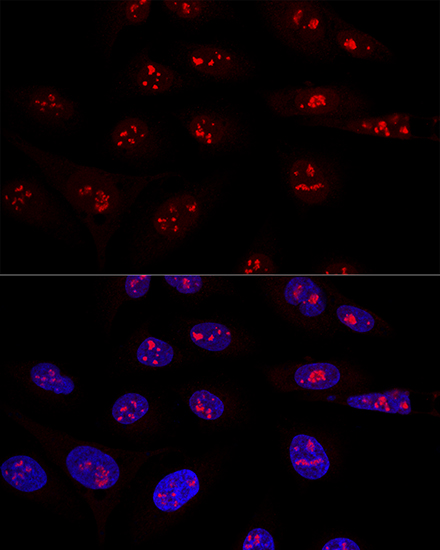 Anti-NOP58 Antibody (CAB14129)