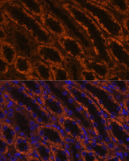 Anti-LAMC2 Antibody (CAB1869)