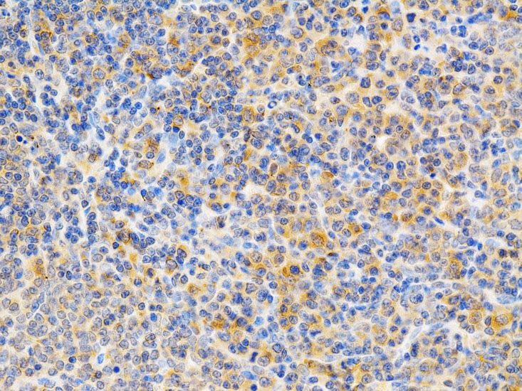 Anti-PRKCE Antibody (CAB2110)