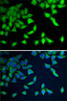 Anti-WDR77 Antibody (CAB7134)