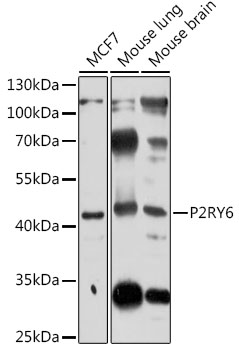 Anti-P2RY6 Antibody (CAB2485)