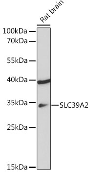 Anti-SLC39A2 Antibody (CAB18452)