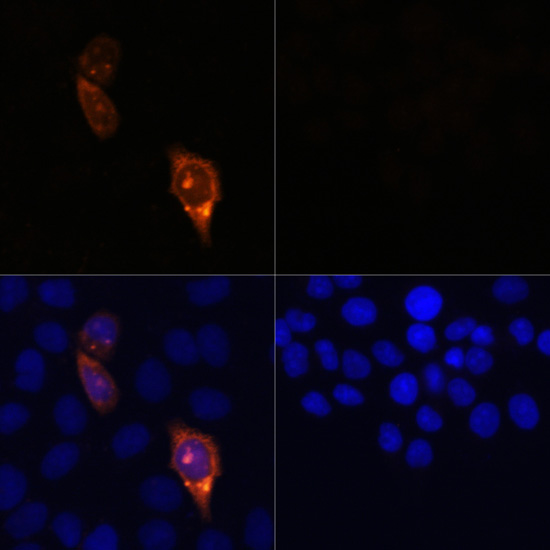 Anti-CAS9 Antibody (CAB14997)