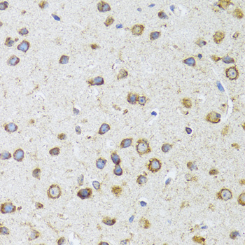 Anti-AIFM3 Polyclonal Antibody (CAB8597)