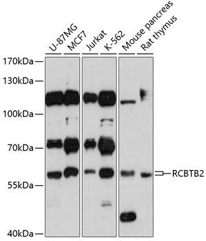 Anti-RCBTB2 Antibody (CAB3785)