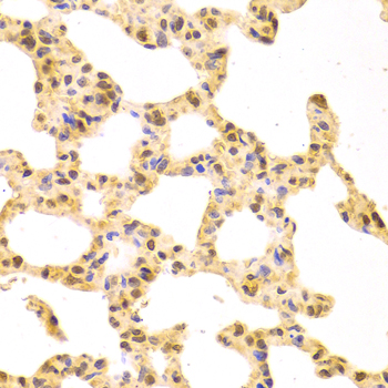 Anti-SRSF1 Antibody (CAB1649)