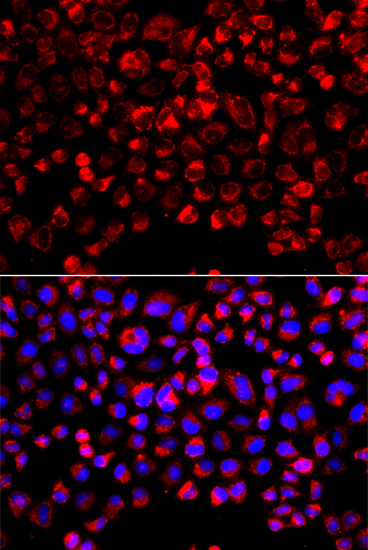 Anti-SULT1E1 Antibody (CAB7452)