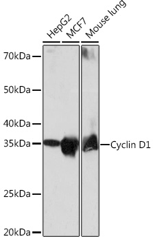 Anti-Cyclin D1 Antibody [KO Validated] (CAB19038)