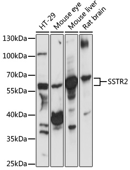 Anti-SSTR2 Antibody (CAB3135)