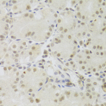 Anti-PRPF3 Antibody (CAB5482)