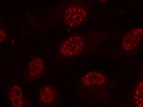 Anti-Phospho-MAPKAPK2-T334 Antibody (CABP0396)