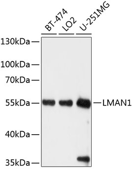 Anti-LMAN1 Antibody (CAB10440)