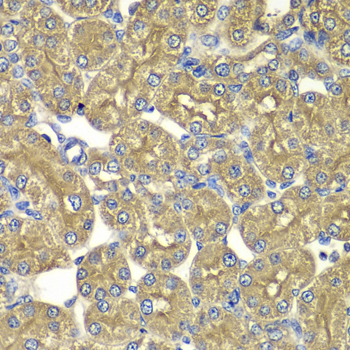 Anti-PSMD5 Antibody (CAB6954)