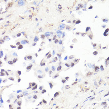 Anti-Phospho-MYC-T58 Antibody (CABP0080)