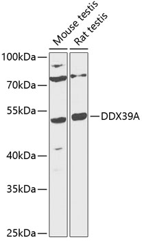 Anti-DDX39A Antibody (CAB12558)