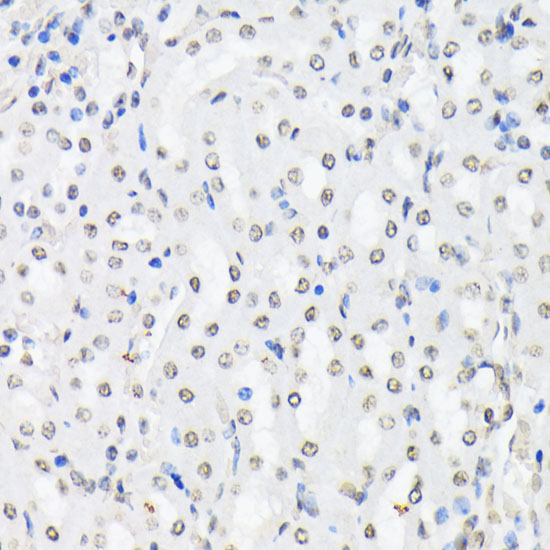 Anti-Phospho-FoxO1-T24/FoxO3a-T32/FoxO4-T28 pAb (CABP0892)