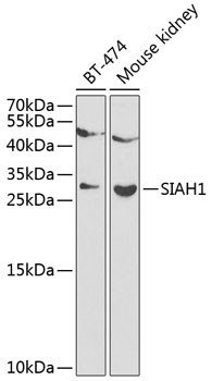 Anti-SIAH1 Antibody (CAB12490)