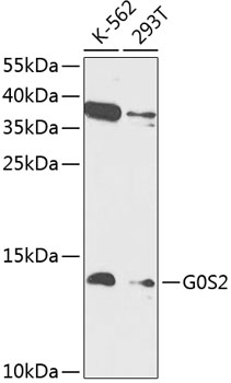 Anti-G0S2 Antibody (CAB14125)