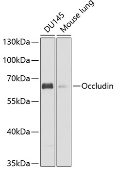 Anti-Occludin Antibody (CAB12621)