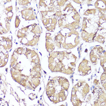 Anti-OPRK1 Antibody (CAB14035)