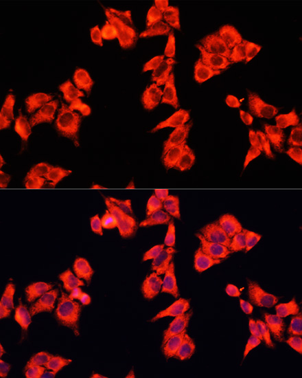 Anti-ARHGAP5 Antibody (CAB3587)