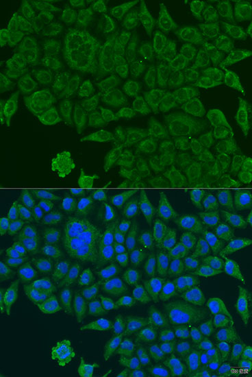 Anti-BCS1L Antibody (CAB7647)