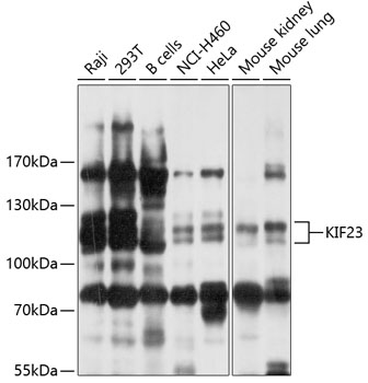 Anti-KIF23 Antibody (CAB10800)