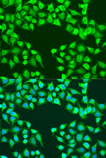 Anti-EDIL-3 Antibody (CAB15772)