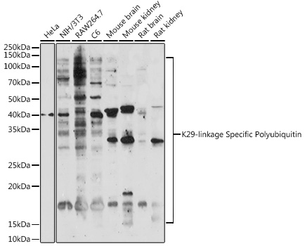 Anti-K29-linkage Specific Polyubiquitin Antibody (CAB18198)